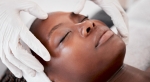 5 things you should know before getting a chemical peel